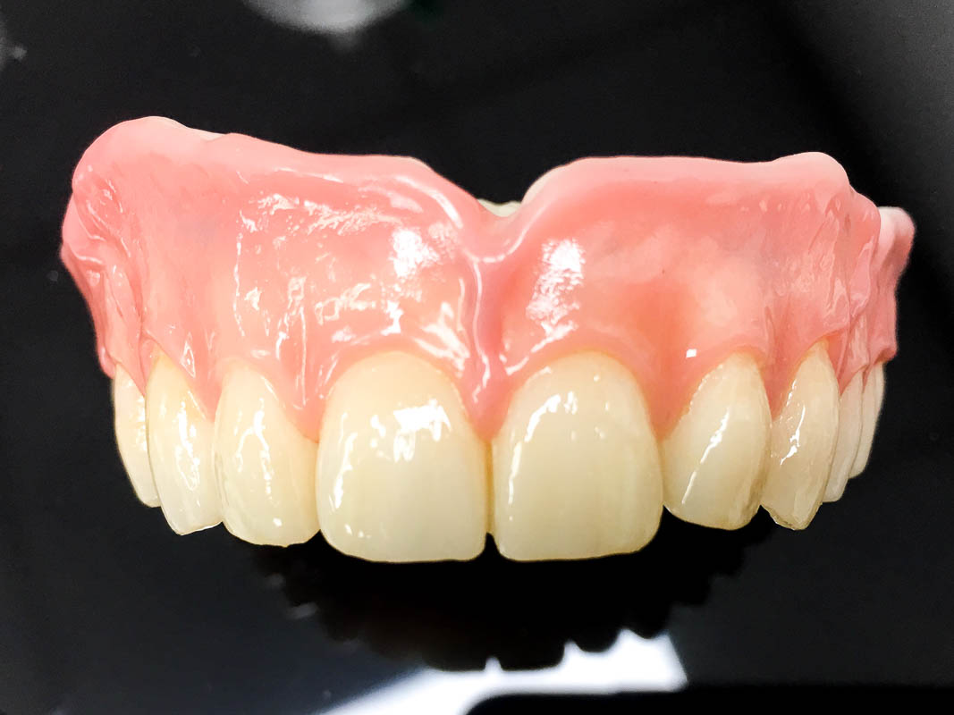 CDL Dentures study 21