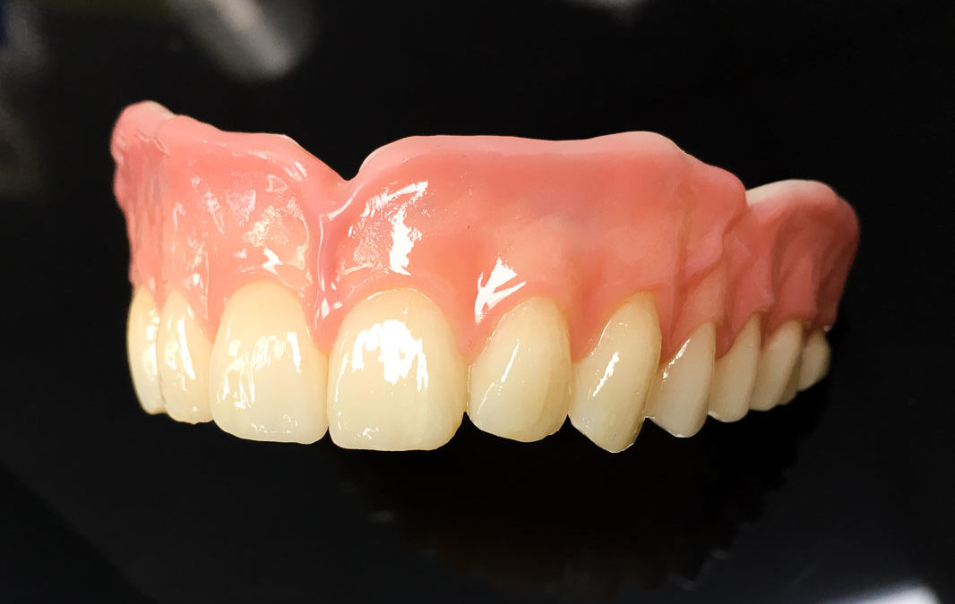 A study on digital dentures
