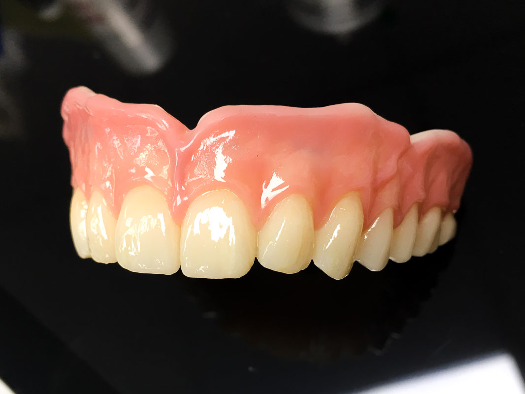 CDL Dentures study 23