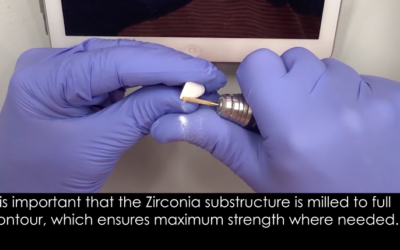 The customisation and veneering of a private windowed Zirconia crown