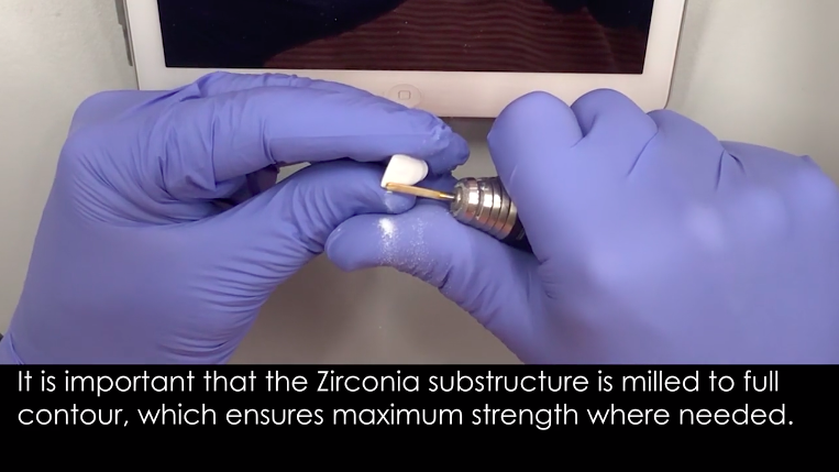 The customisation and veneering of a private windowed Zirconia crown