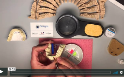 The fabrication of tooth bound restorations