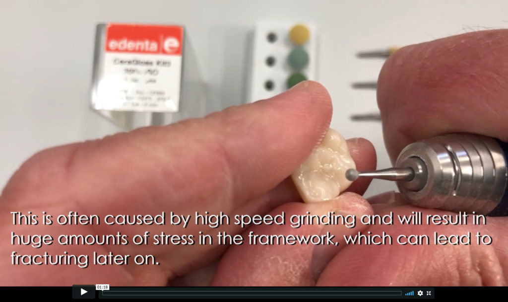 cdl-how-to-adjust-full-contour-zirconia-crown