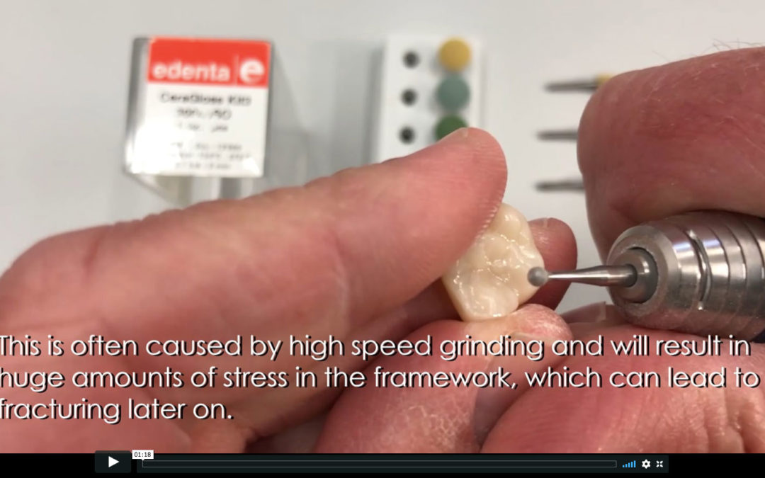 CDL’s tips on how to successfully adjust full Contour Zirconia crown