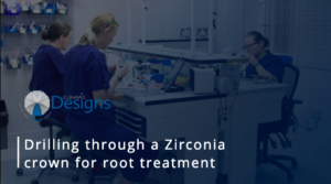 Drilling through a Zirconia crown for root treatment