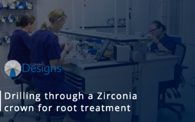 Drilling through a Zirconia crown for root treatment